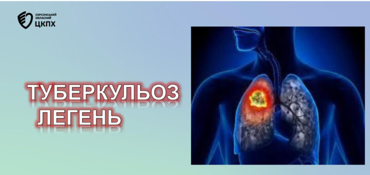 ТУБЕРКУЛЬОЗ ЛЕГЕНЬ