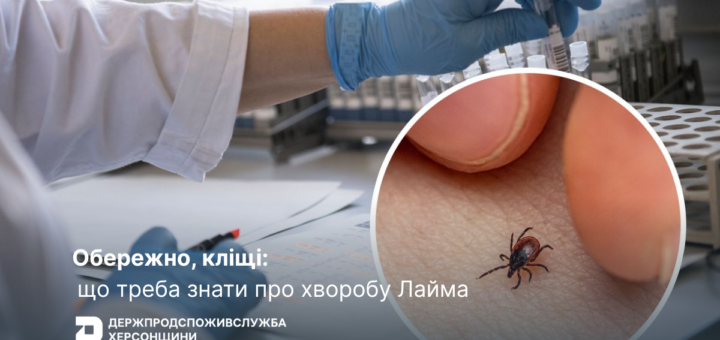 Обережно, кліщі: що треба знати про хворобу Лайма