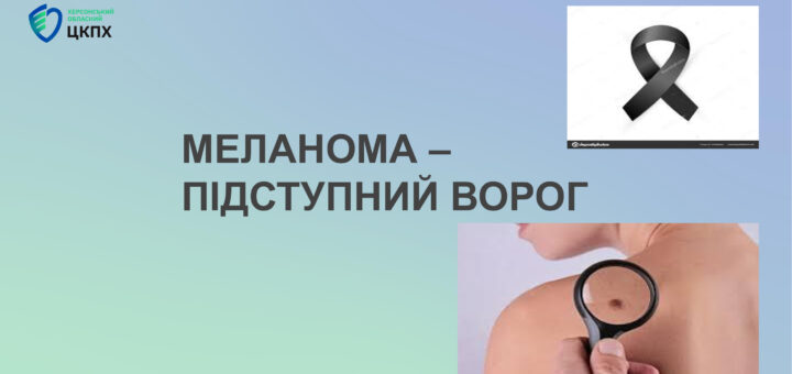 МЕЛАНОМА – ПІДСТУПНИЙ ВОРОГ