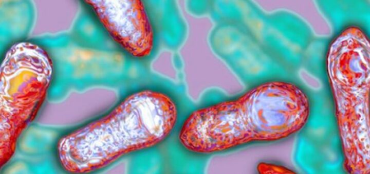 Профілактика ботулізму: нагадуємо основні правила