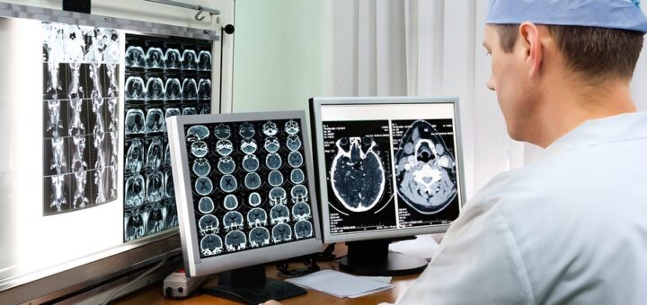 Інсульт: що варто знати кожному