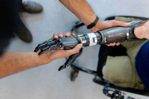 Людина у візку отримує допомогу з високотехнологічним протезом руки, який налаштовує інший спеціаліст